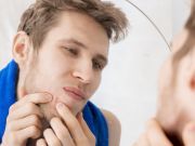 Why You Are a Pimple Popping Fanatic