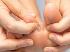 Foot Fungus Fixes You Can Make at Home