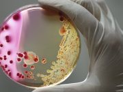 These Easy Tricks Can Help Increase Your Natural Antibodies