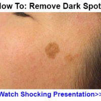 darkspot5-300×250 (1)