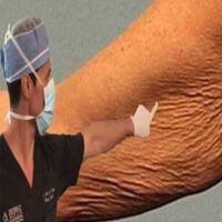 dermalpoint-300×600