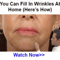 wrinkle-laykelady-300×250