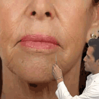 wrinklelaykepoint-300×600