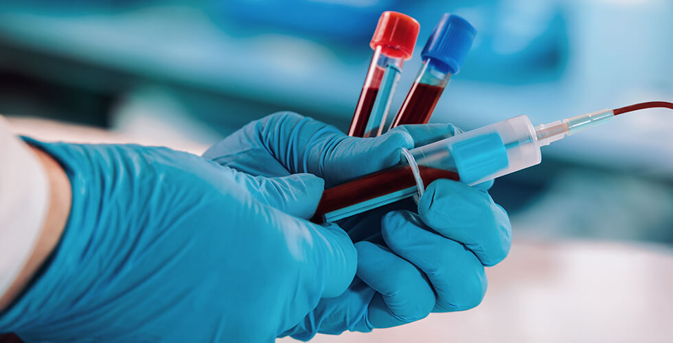 Can You Clean Your Blood? Here’s What Science Says