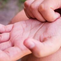 SurprisingReasonsWhyYourPalmsItch_AltDaily_980x500